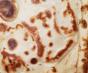 thumbnail image 1