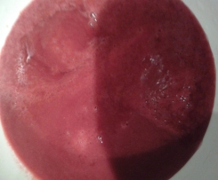 Himbeermarmelade und Himbeersirup